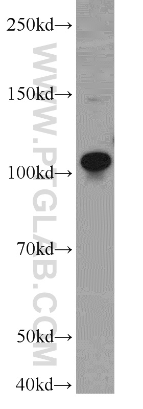 WB analysis of K-562 using 14525-1-AP