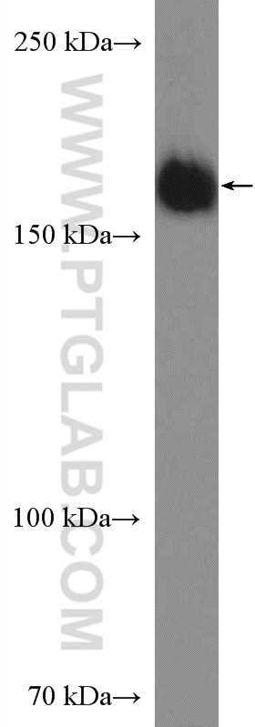 WB analysis of HeLa using 23340-1-AP