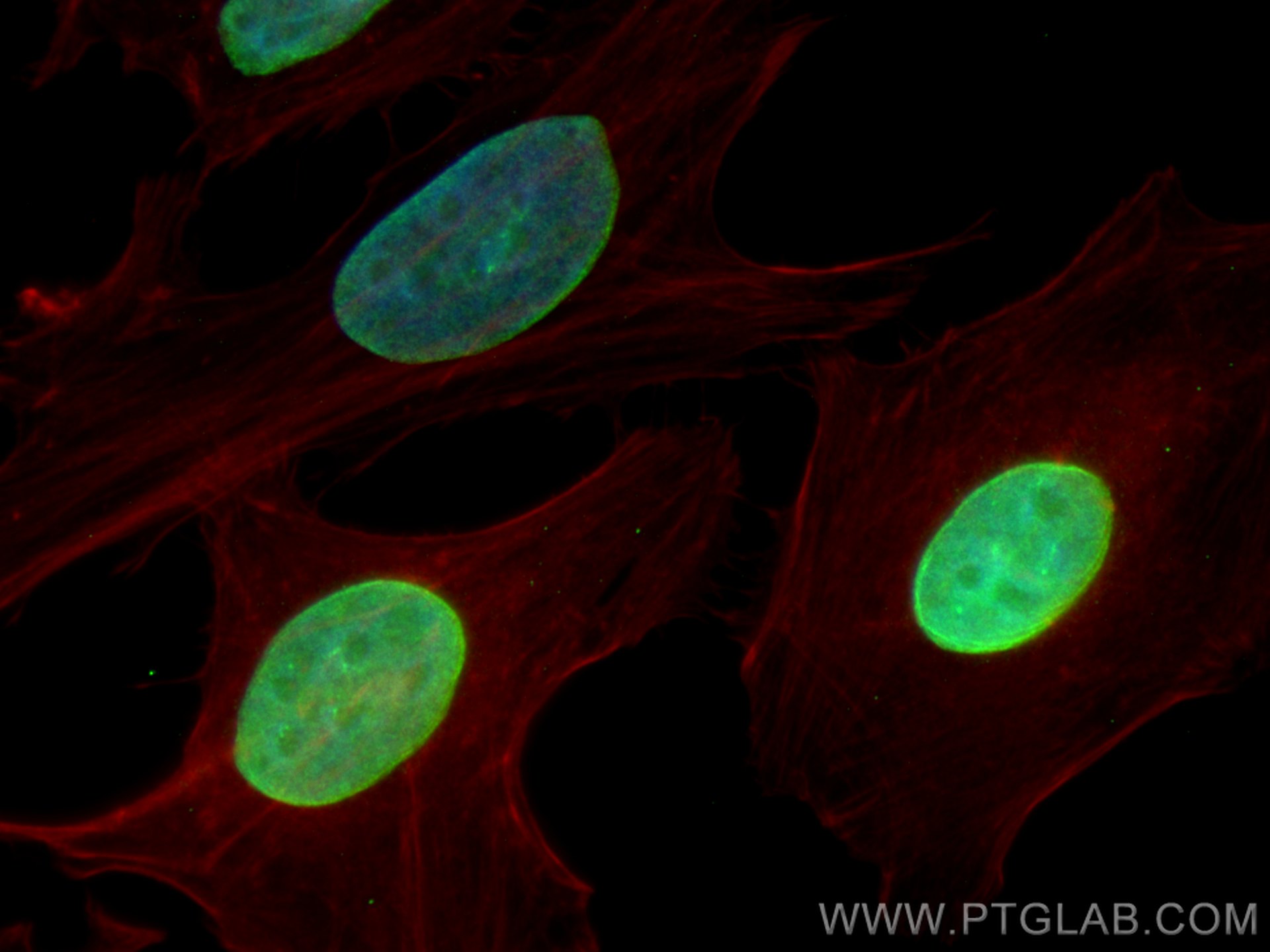 IF Staining of HeLa using 21459-1-AP