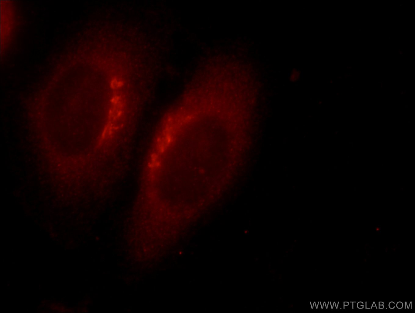 IF Staining of HepG2 using 19511-1-AP