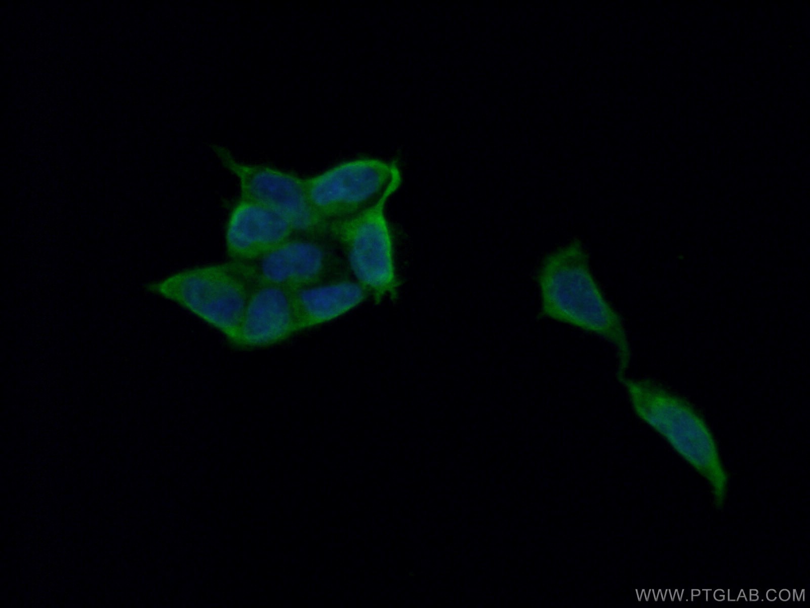 IF Staining of HEK-293 using 10647-1-AP
