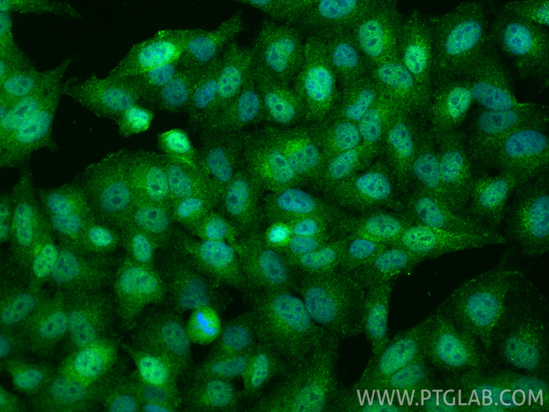 IF Staining of HepG2 using RMX00047 IF Staining of HepG2 using RMX00047