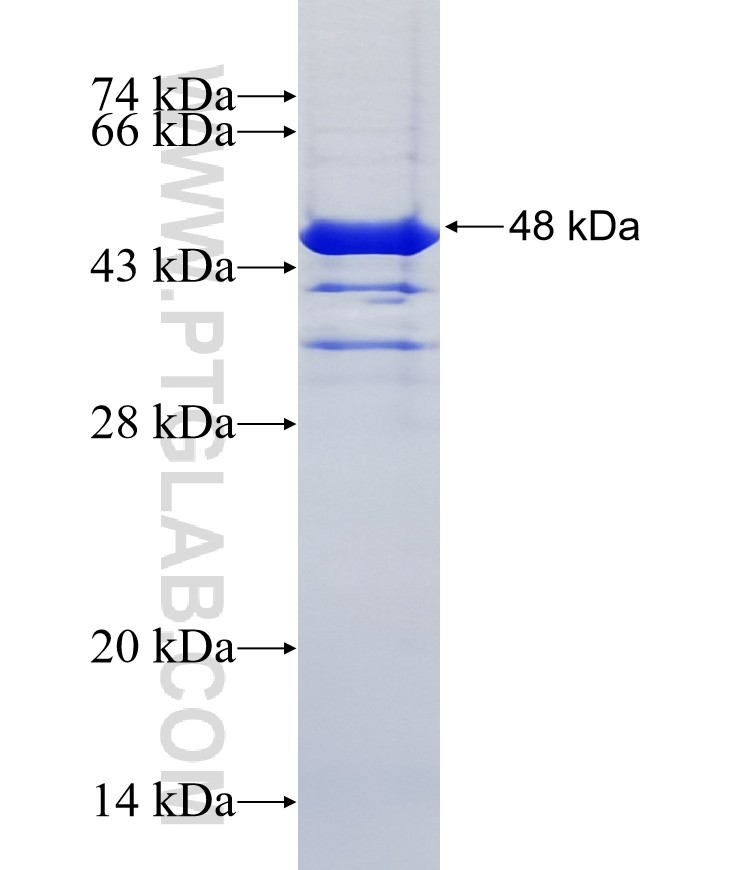TOX4 fusion protein Ag27638 SDS-PAGE