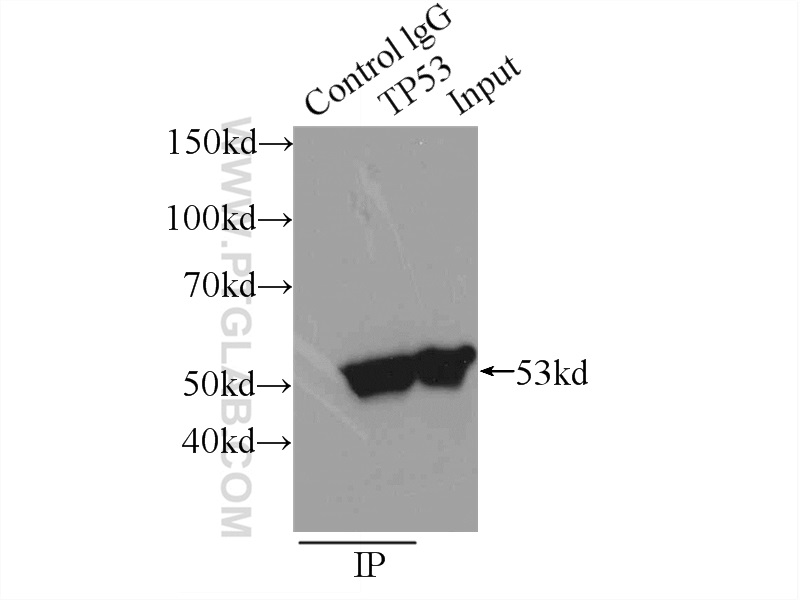 IP experiment of A431 using 21891-1-AP