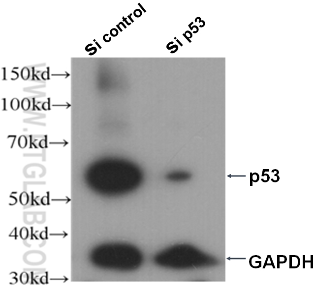 WB analysis of A431 cells using 21891-1-AP