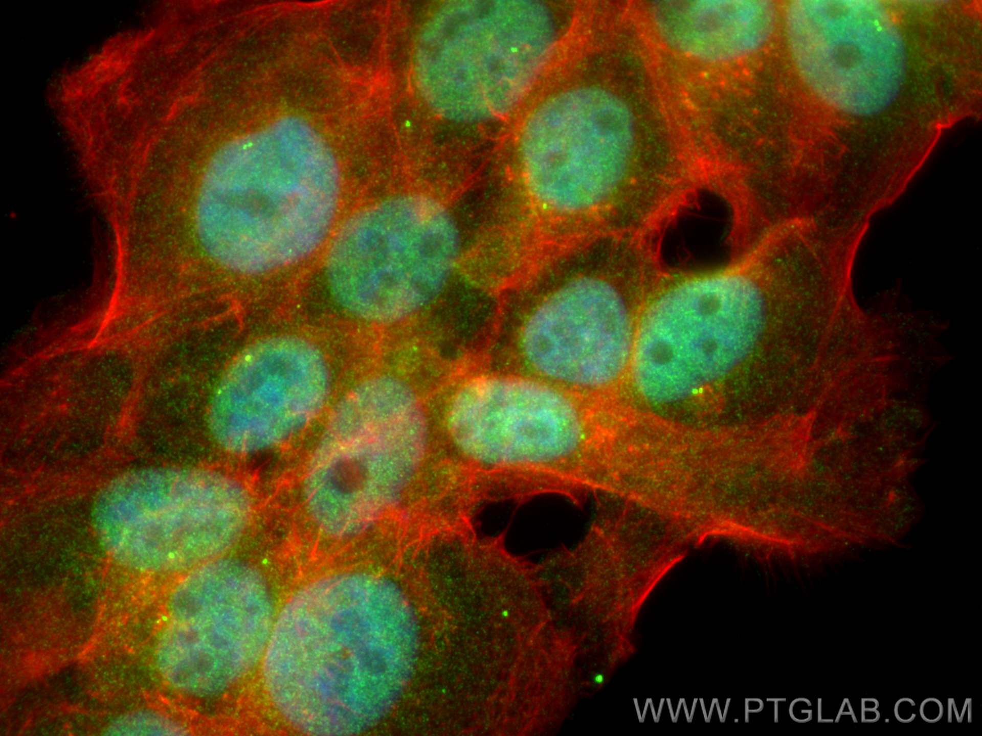 IF Staining of A431 using 17872-1-AP