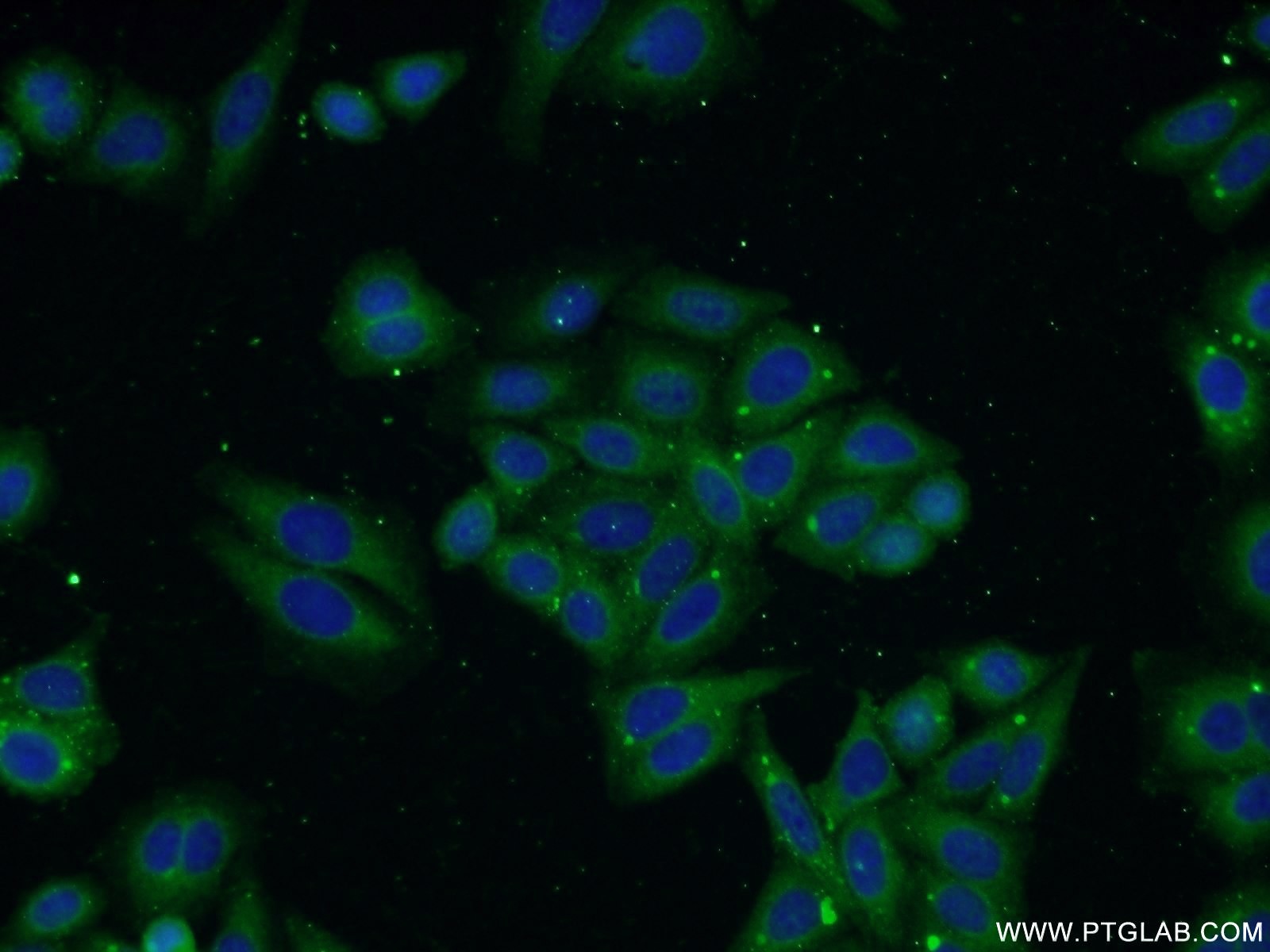 IF Staining of HepG2 using 17872-1-AP