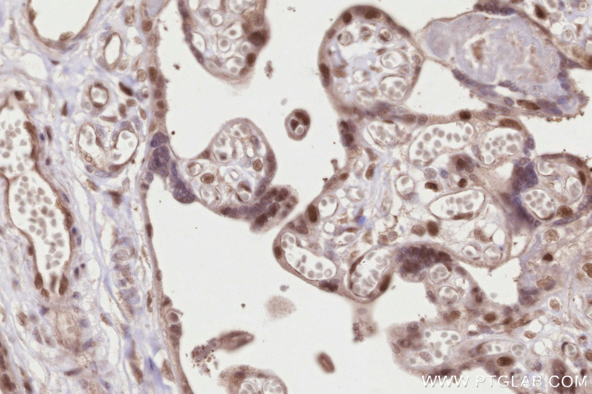 IHC staining of human placenta using 26818-1-AP