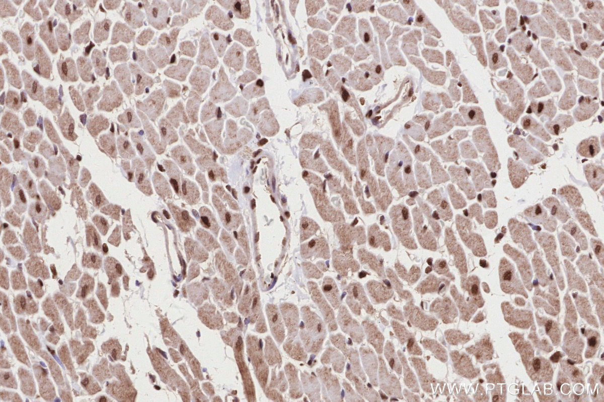 IHC staining of rat heart using 26818-1-AP