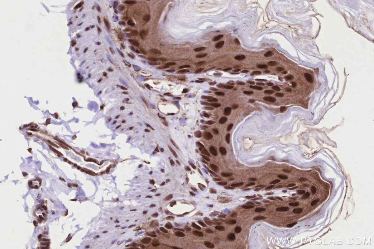 IHC staining of mouse stomach using 26818-1-AP
