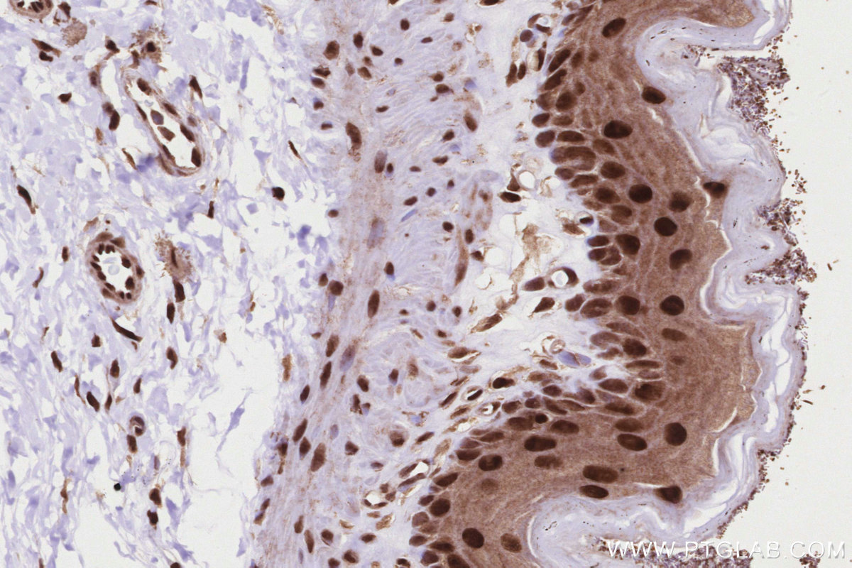 IHC staining of rat stomach using 26818-1-AP