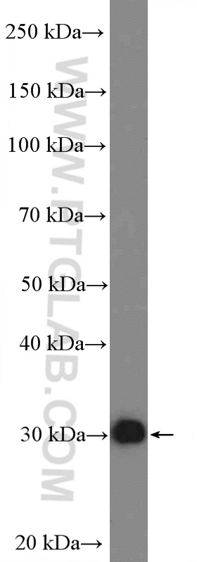 WB analysis of Jurkat using 26818-1-AP