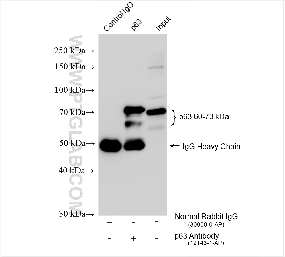 IP experiment of A431 using 12143-1-AP