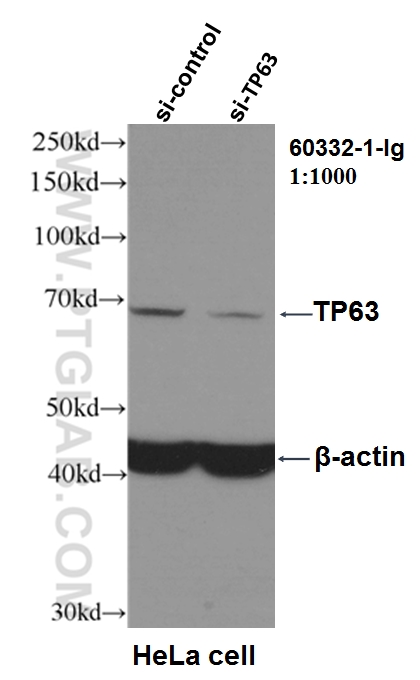 WB analysis of HeLa using 60332-1-Ig