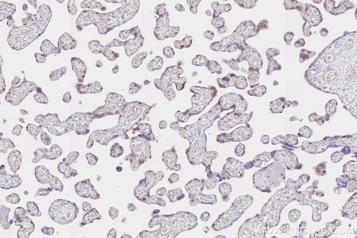IHC staining of human placenta using 60332-2-Ig IHC staining of human placenta using 60332-2-Ig