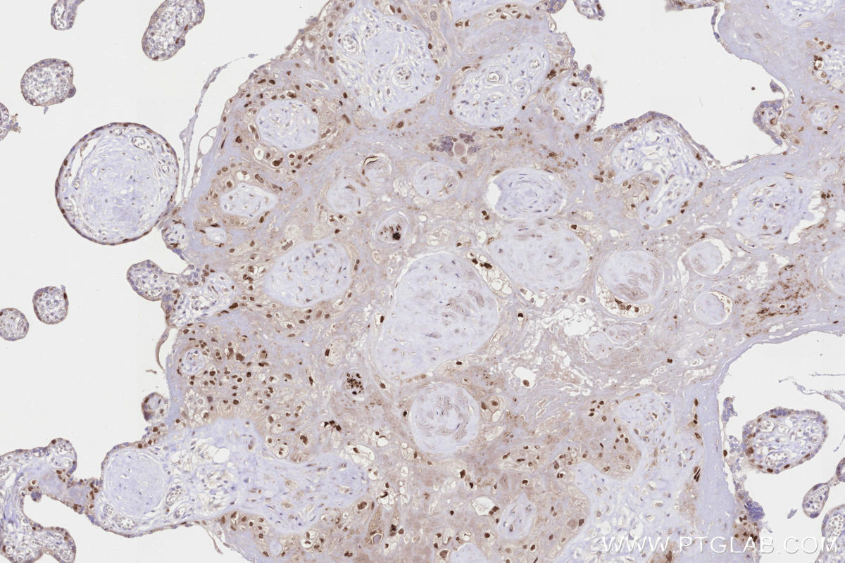 IHC staining of human placenta using 60332-2-Ig IHC staining of human placenta using 60332-2-Ig
