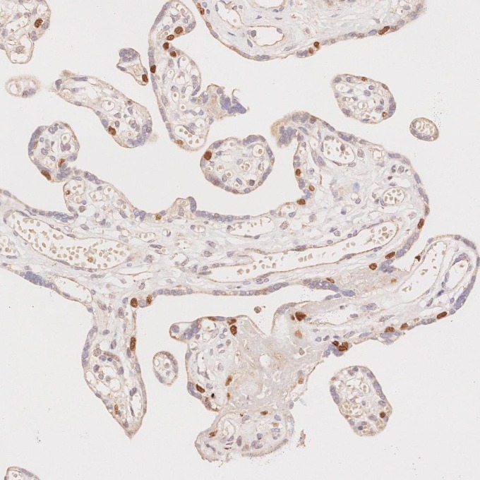 IHC staining of human placenta using 60332-2-Ig IHC staining of human placenta using 60332-2-Ig