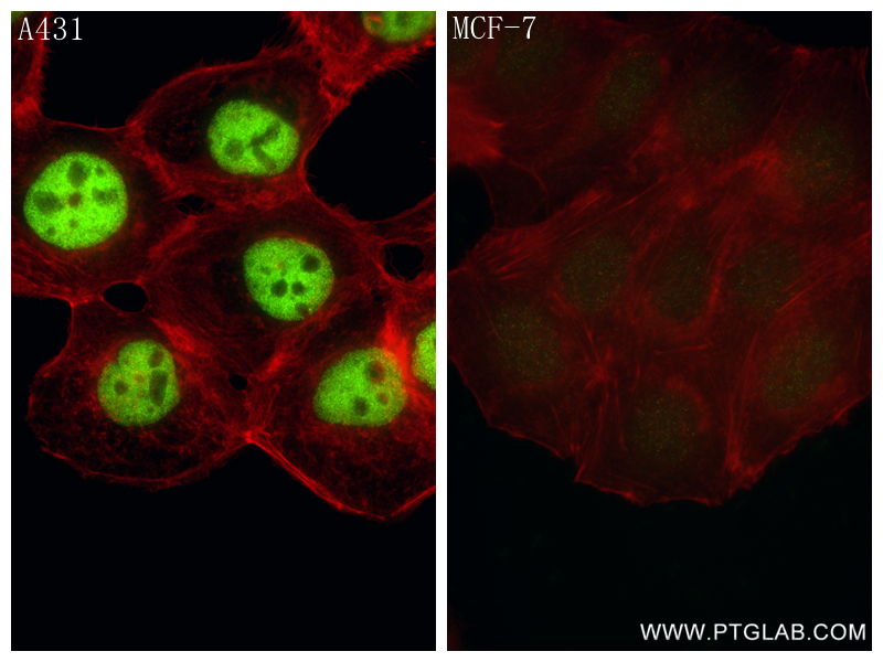 IF Staining of A431 using 86154-1-RR