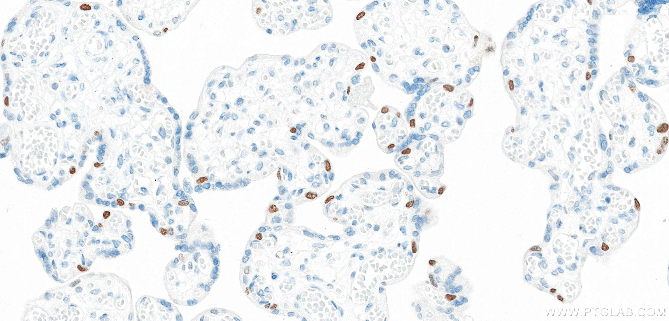 IHC staining of human placenta using 86154-1-RR IHC staining of human placenta using 86154-1-RR