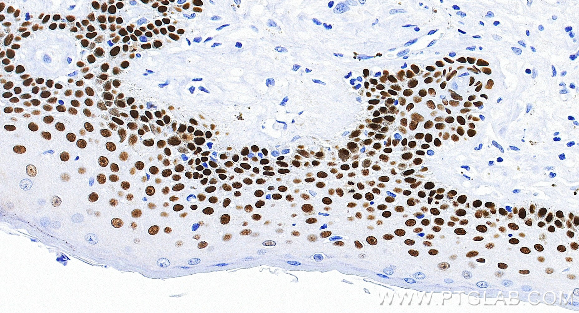 IHC staining of human skin using 86154-1-RR