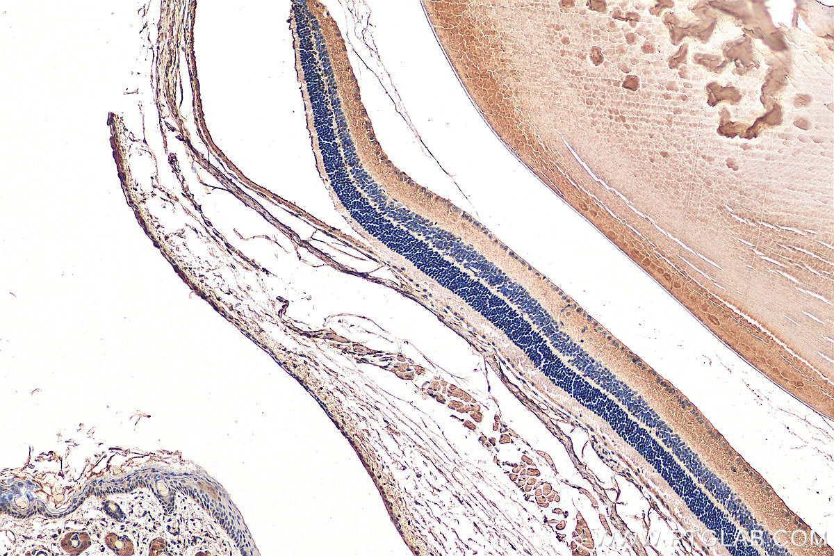 IHC staining of mouse eye using 29394-1-AP