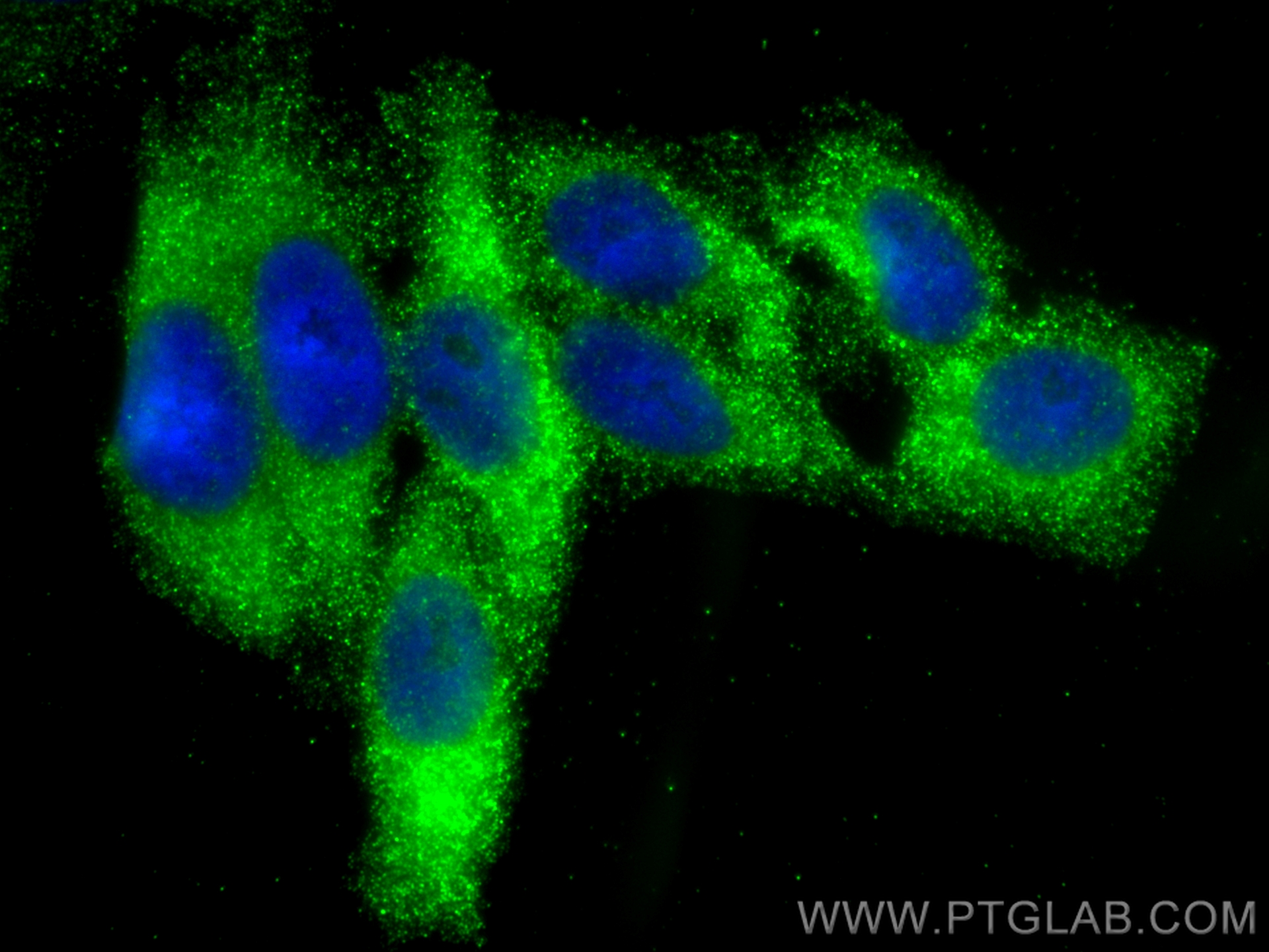 IF Staining of HepG2 using 23758-1-AP (same clone as 23758-1-PBS)