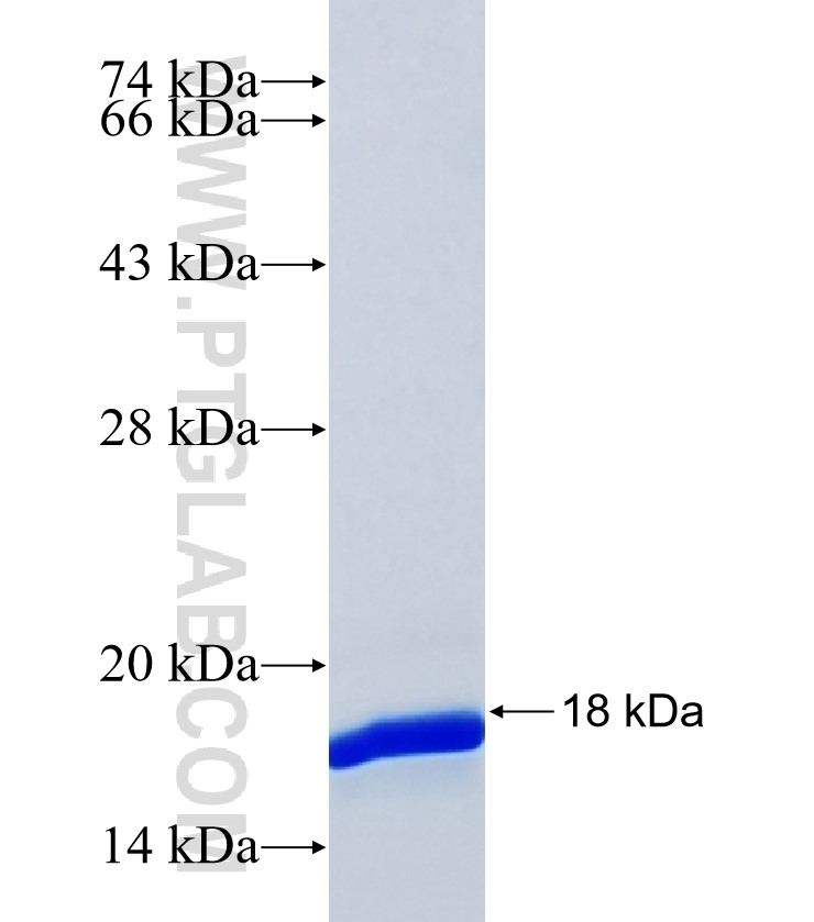 TPCN2 fusion protein Ag38994 SDS-PAGE TPCN2 fusion protein Ag38994 SDS-PAGE