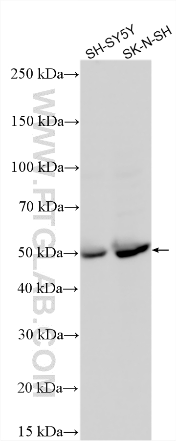 WB analysis using 29904-1-AP