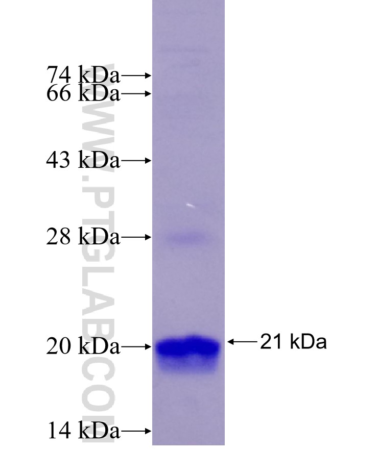 TPH1 fusion protein Ag29473 SDS-PAGE TPH1 fusion protein Ag29473 SDS-PAGE