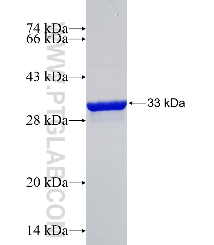 TPH1 fusion protein Ag31623 SDS-PAGE