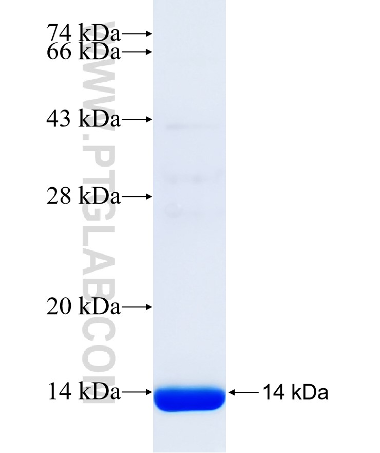 TPH1 fusion protein Ag31635 SDS-PAGE TPH1 fusion protein Ag31635 SDS-PAGE