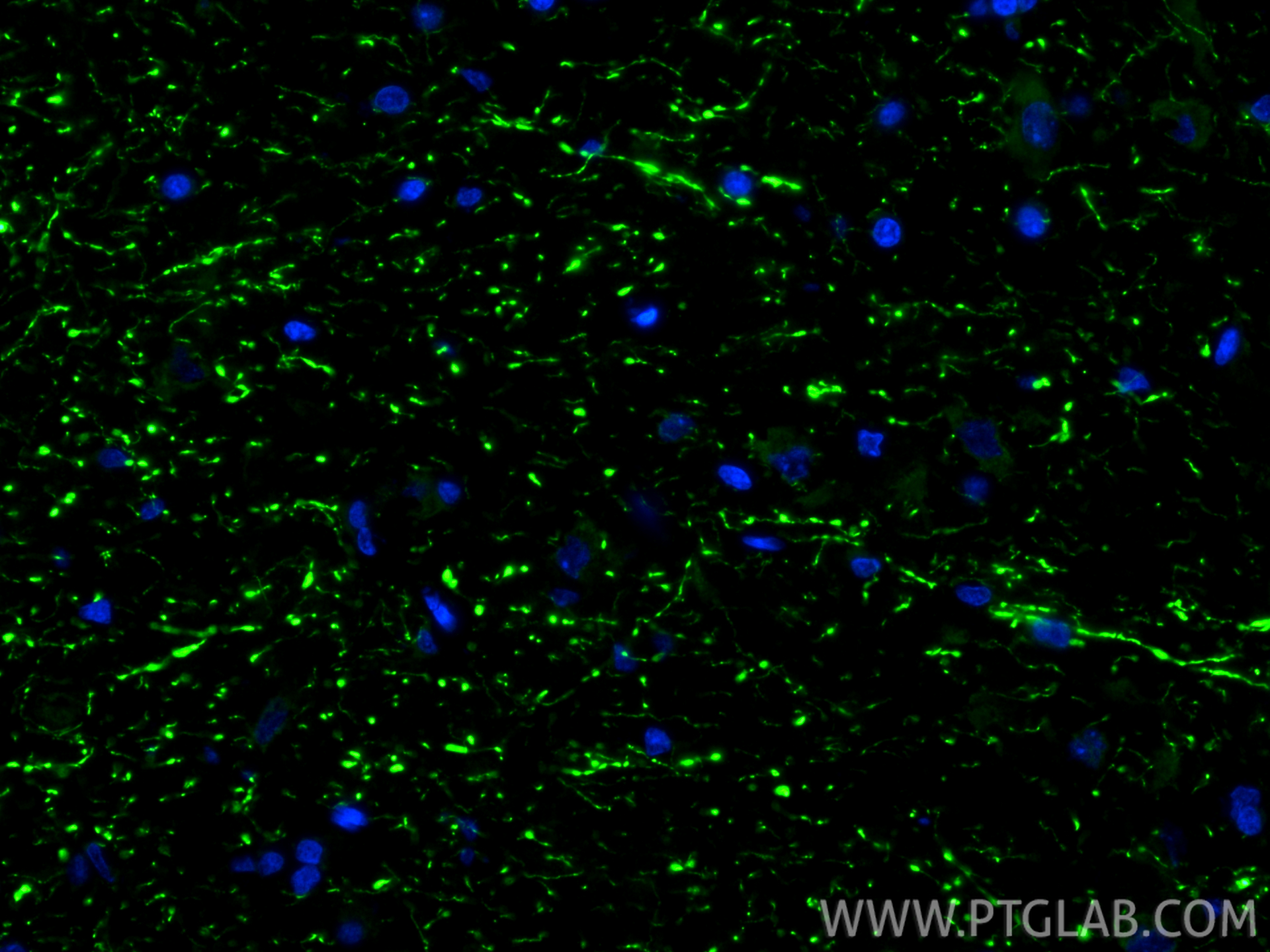 IF Staining of rat brain using 29283-1-AP IF Staining of rat brain using 29283-1-AP