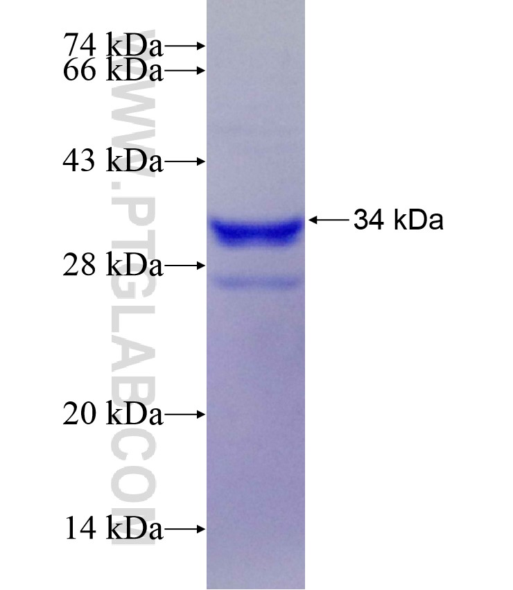 TPH2 fusion protein Ag18408 SDS-PAGE
