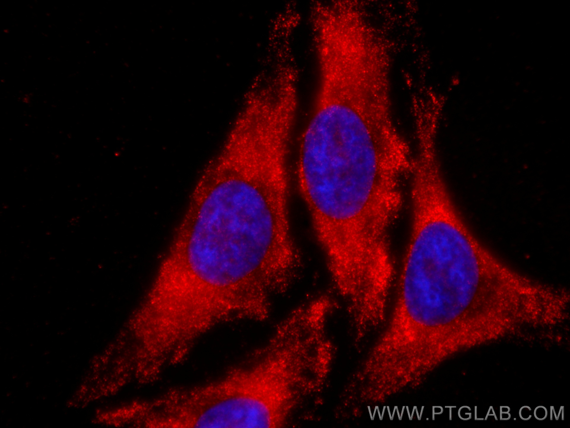 IF Staining of HeLa using CL594-67515