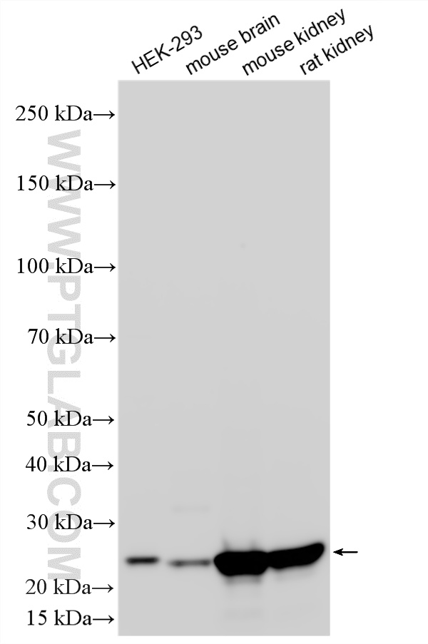WB analysis using RMX00090 WB analysis using RMX00090