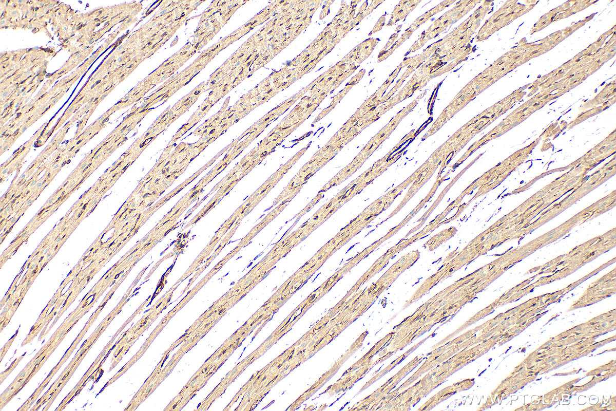 Immunohistochemical analysis of paraffin-embedded rat heart tissue slide using 28477-1-AP (TPM1 antibody) at dilution of 1:1000 (under 10x lens). Heat mediated antigen retrieval with Tris-EDTA buffer (pH 9.0). IHC staining of rat heart using 28477-1-AP