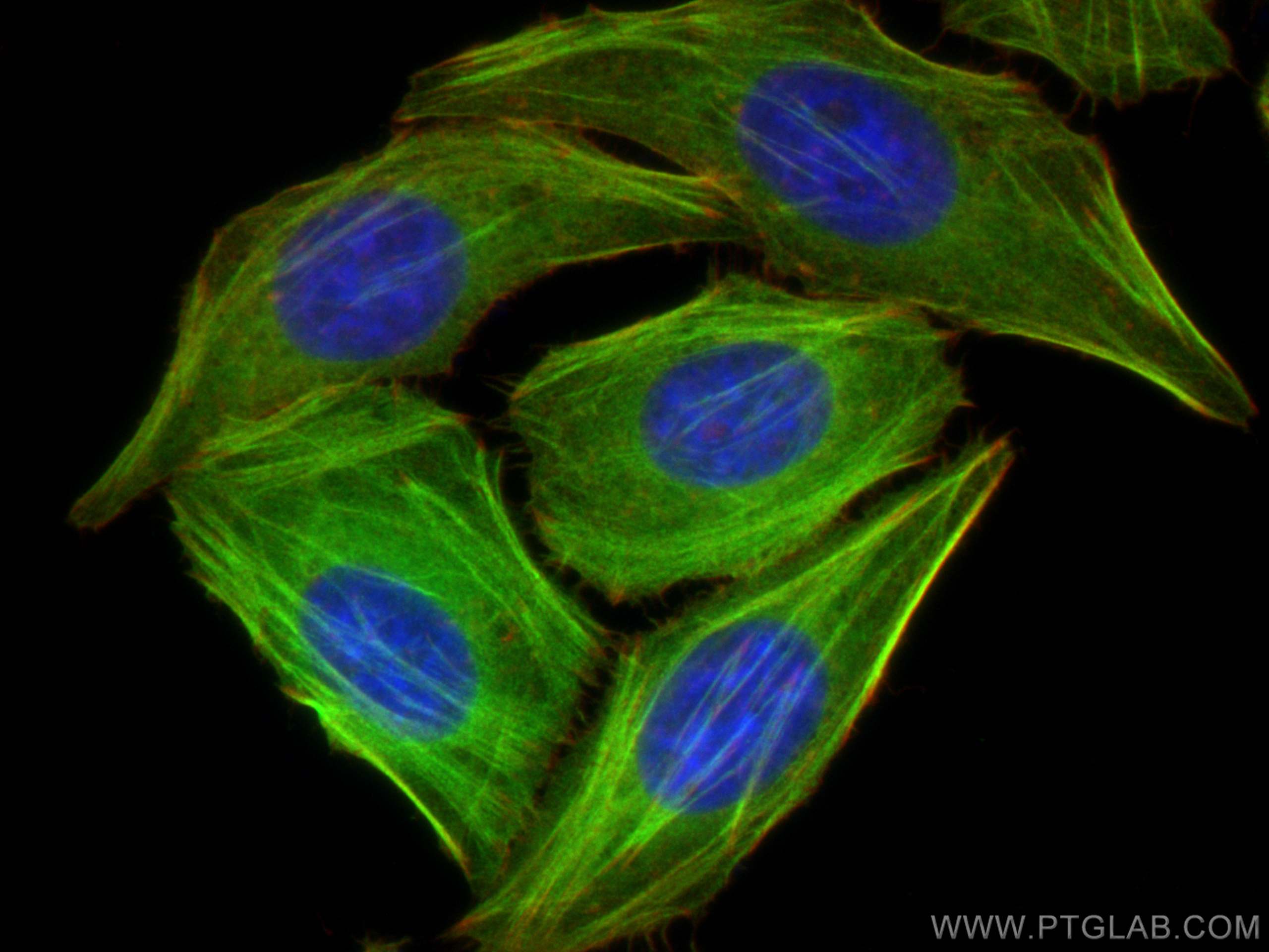 IF Staining of HepG2 using 11038-1-AP