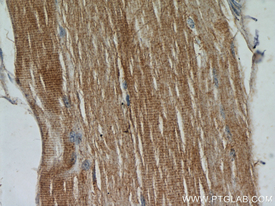 IHC staining of human skeletal muscle using 11038-1-AP