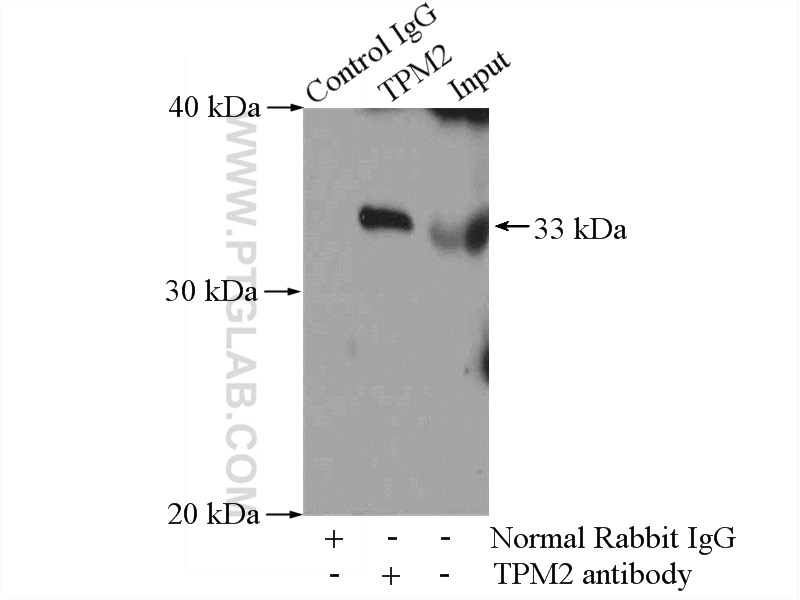 IP experiment of mouse skeletal muscle using 11038-1-AP