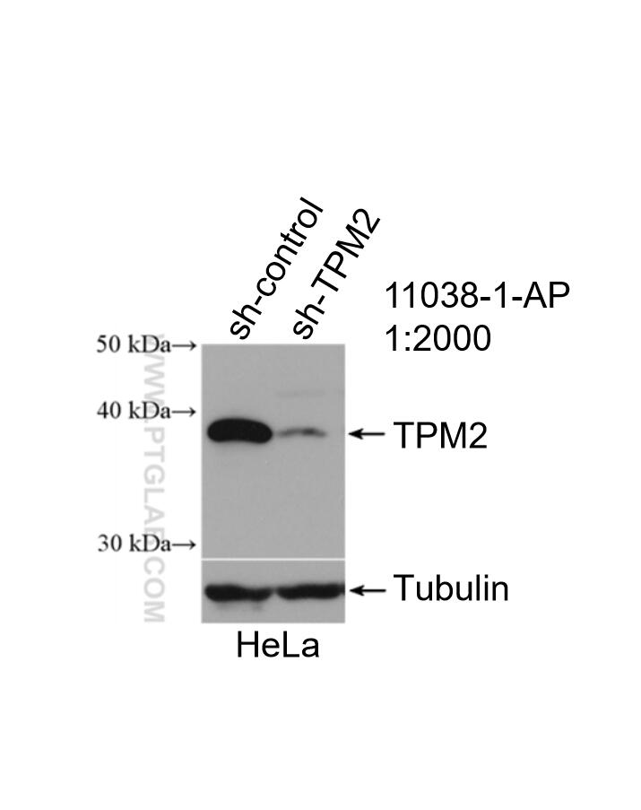 WB analysis of HeLa using 11038-1-AP