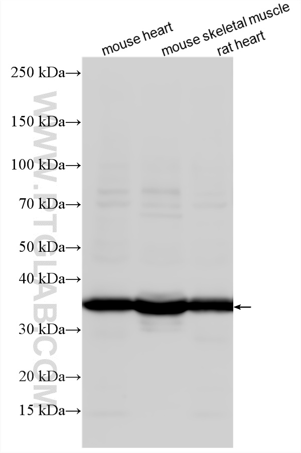 Various lysates were subjected to SDS PAGE followed by western blot with 10737-1-AP (TPM3 antibody) at dilution of 1:40000 incubated at room temperature for 1.5 hours. WB analysis using 10737-1-AP
