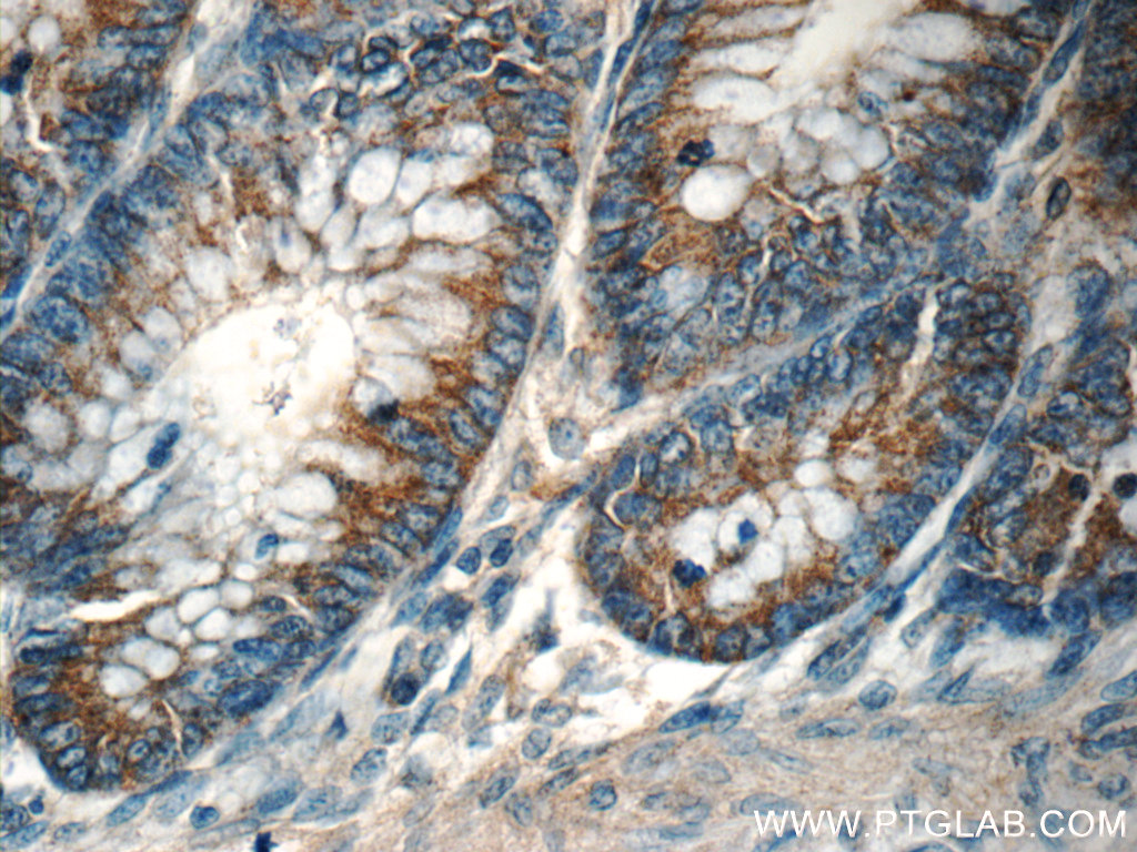 TPM3 Polyclonal antibody