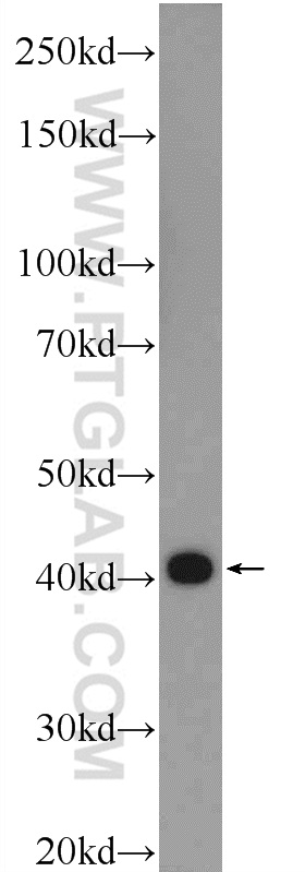 WB analysis of mouse skeletal muscle using 55444-1-AP