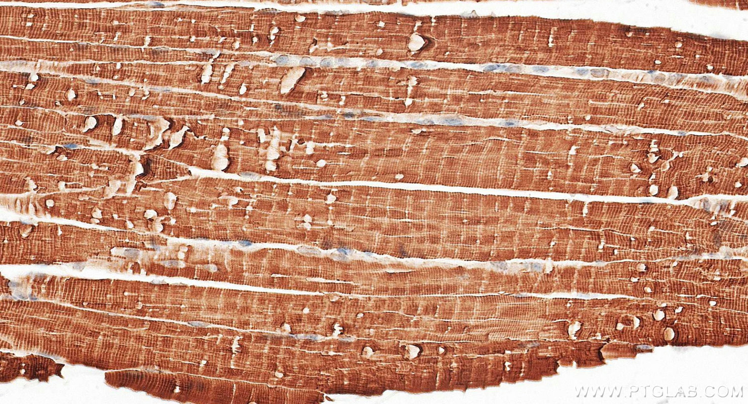 IHC staining of mouse skeletal muscle using 68158-1-Ig IHC staining of mouse skeletal muscle using 68158-1-Ig