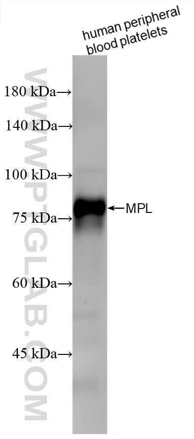 WB analysis of human peripheral blood platelets using 86495-3-RR