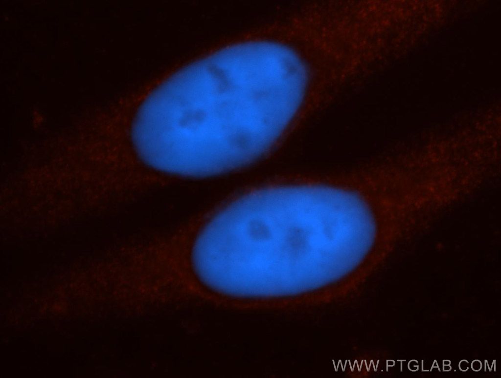 IF Staining of HepG2 using 14120-1-AP