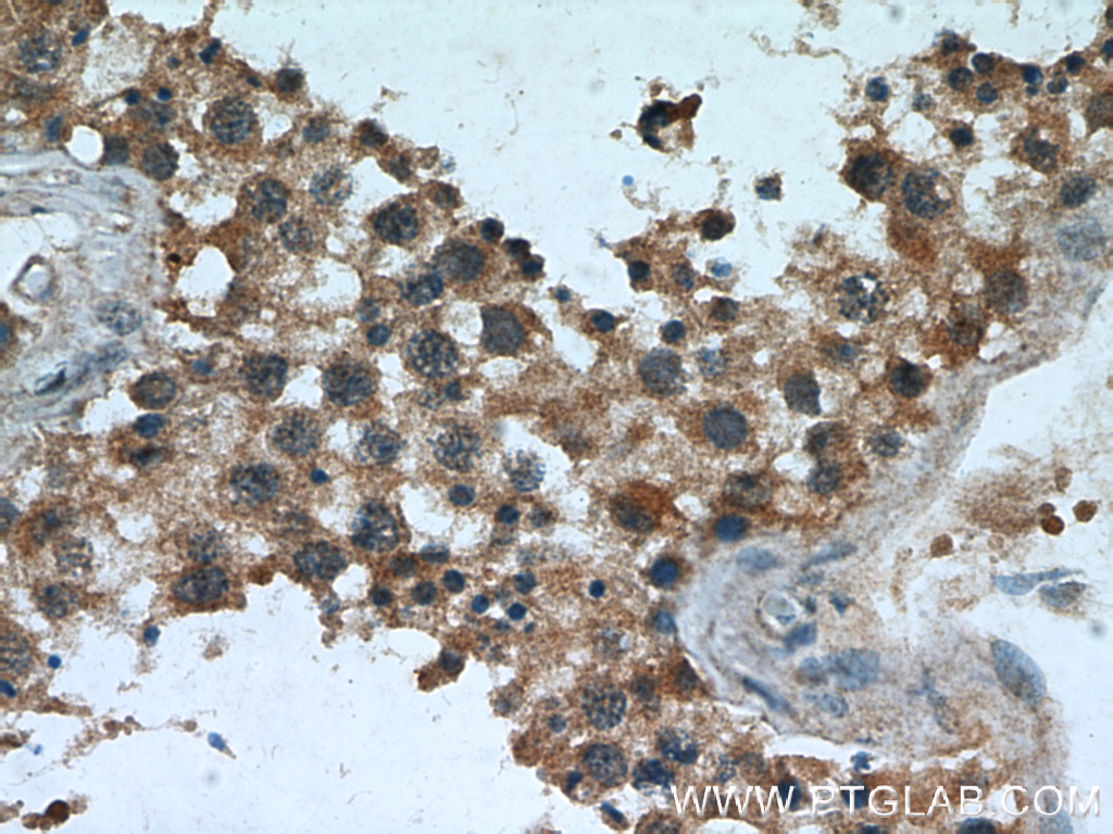 IHC staining of human testis using 66017-1-Ig