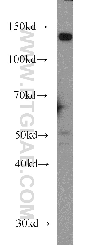 WB analysis of HeLa using 66017-1-Ig