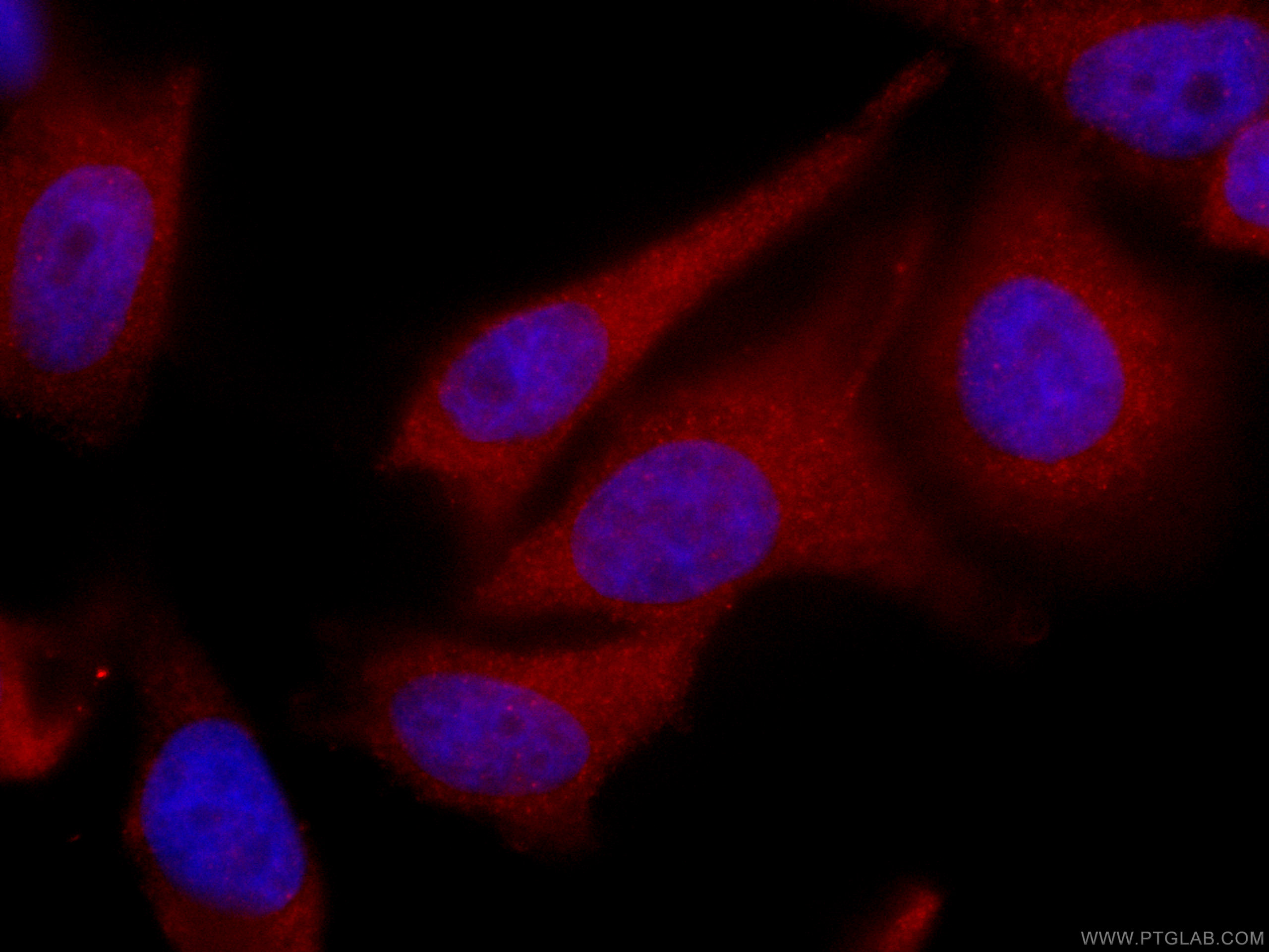 IF Staining of HeLa using CL594-66017