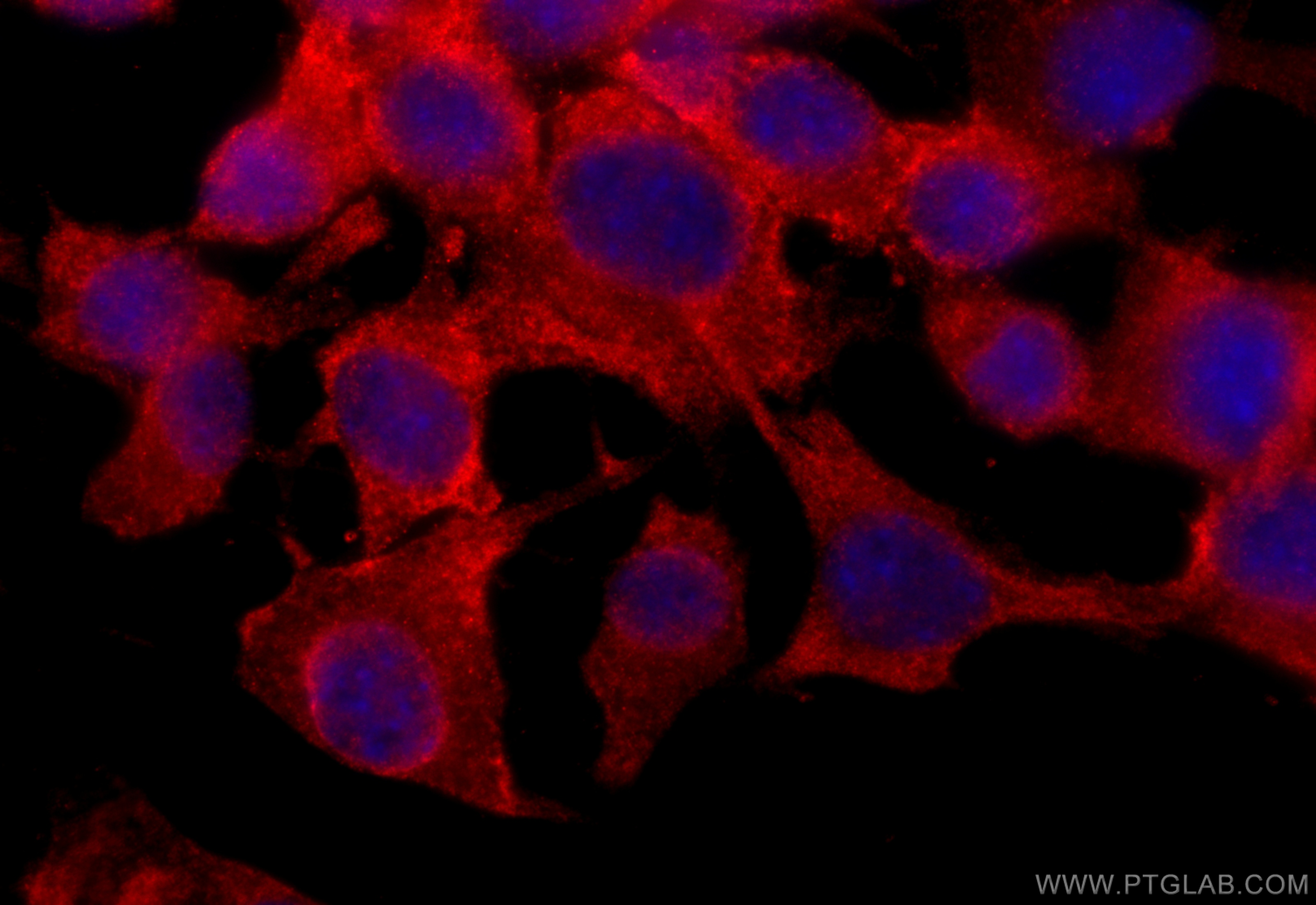 IF Staining of Neuro-2a using 18742-1-AP
